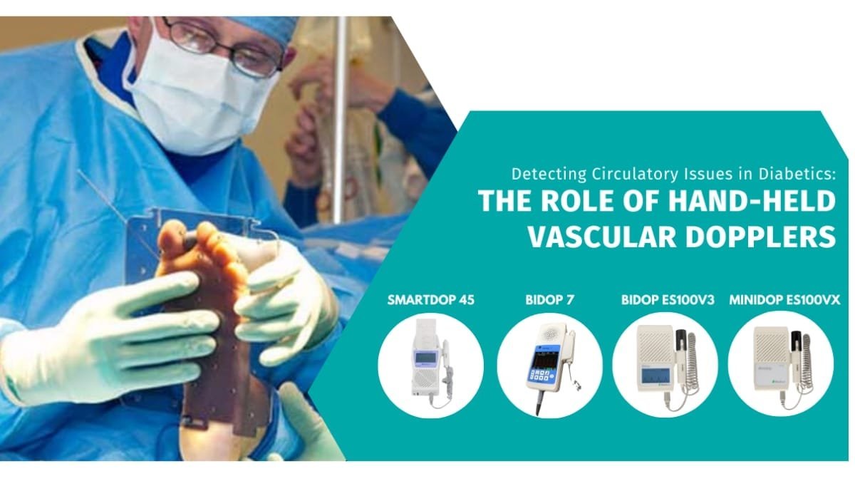 How Hand-Held Vascular Dopplers Help Detect Circulatory Issues in Diabetics